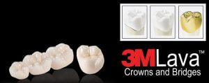 phuket dental, dental phuket, patong dental, phuket dental in thailand, dental crowns, dental crown center