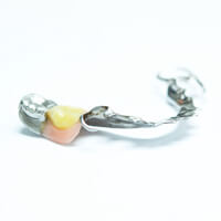 phuket dental, dental phuket, patong dental, phuket dental in thailand, dental denture, metal frame