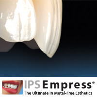 phuket dental, dental phuket, patong dental, phuket dental in thailand, dental veneers, ips empress veneers